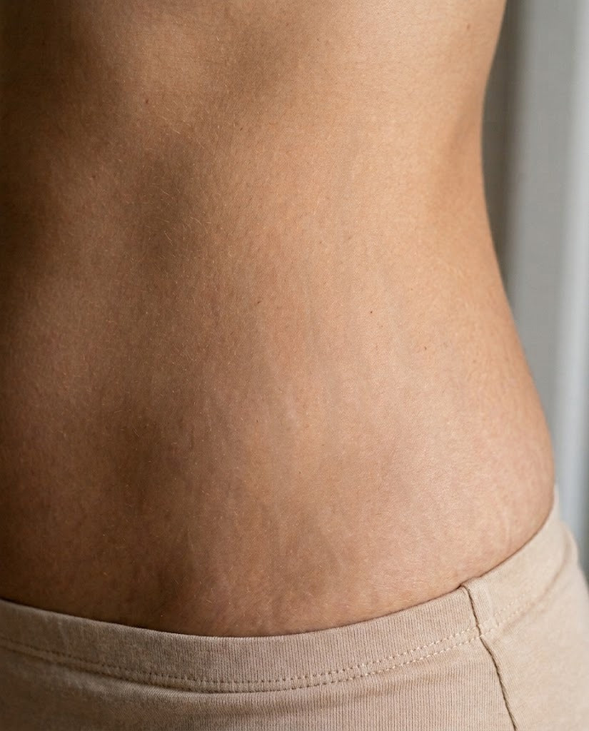 Vergetures après la crème Strio Derm